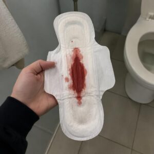 what about irregular or heavy bleeding